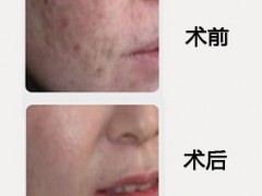 简介：