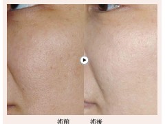 简介：