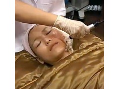 微针美容1图2