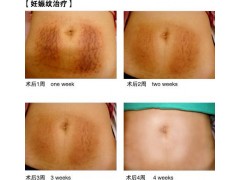 微针美塑图3