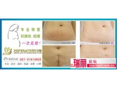 微针加盟图2