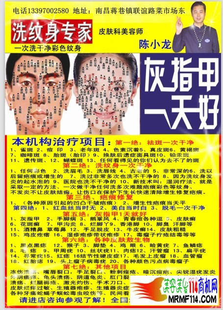 灰指甲足病治疗 (4)