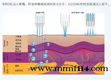 无针水光1